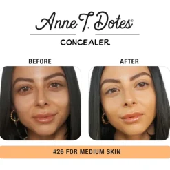 Anne T. Dote Concealer