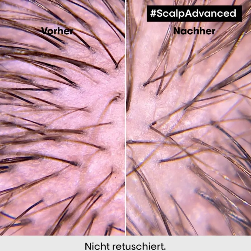 Anti-Discomfort Intense Soother Treatment