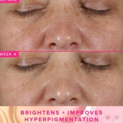 Brighten Up 3% TXA Dark Spot Toner