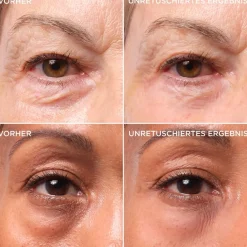 Bye Bye Under Eye Bags