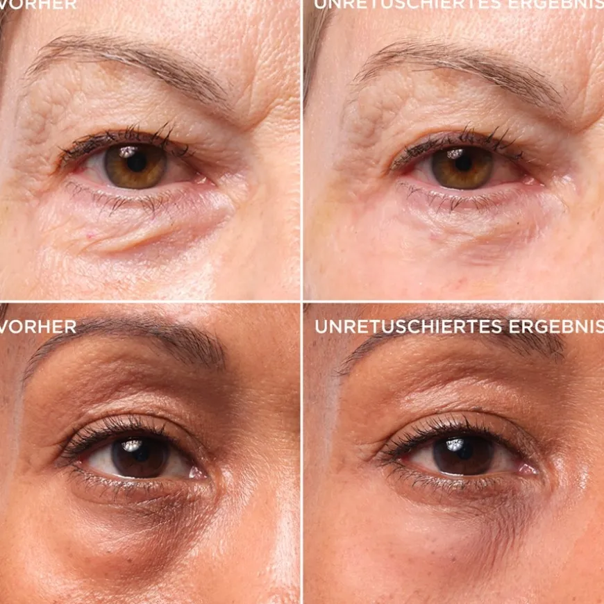 Bye Bye Under Eye Bags