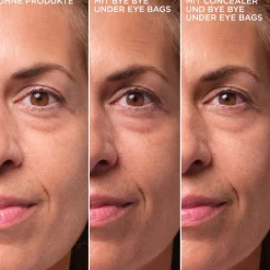 Bye Bye Under Eye Bags