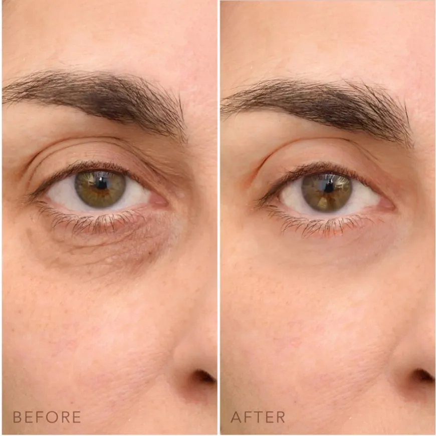 C - Concentrated Eye Cream