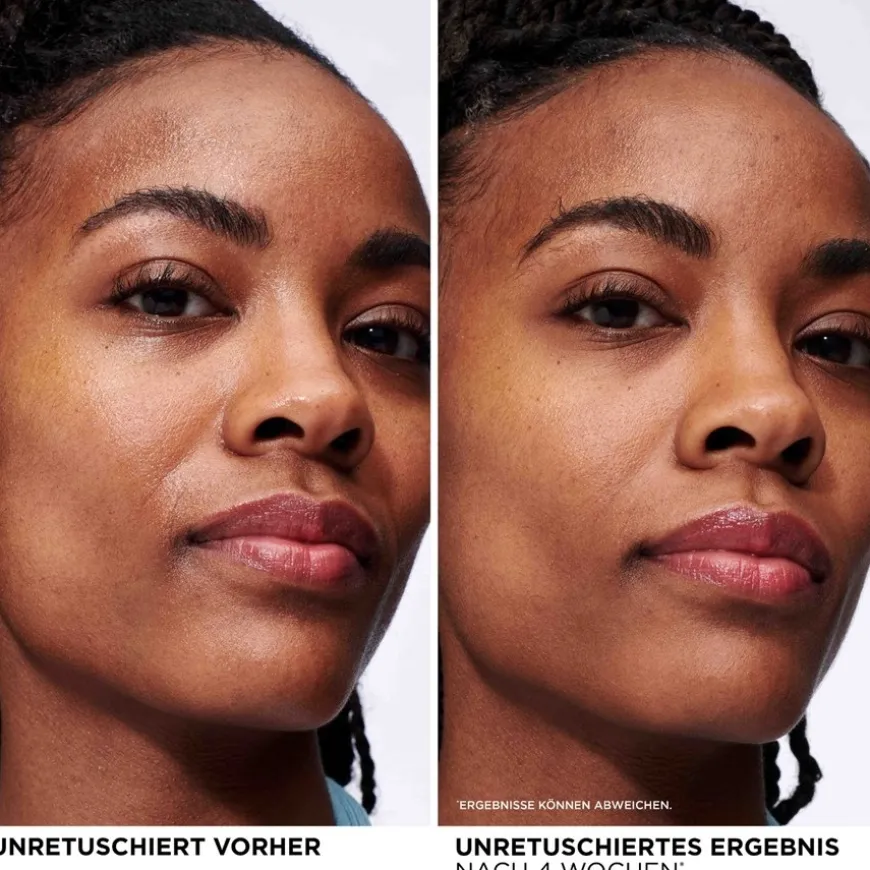 Confidence in a Gel Cream