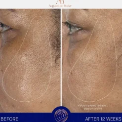 De navulling van Serum Nomad