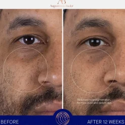 De navulling van Serum Nomad