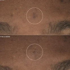 Even Better Clinical Brightening Moisturizer