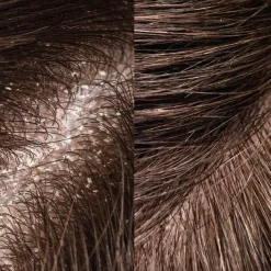 Exfoliërende Haarborstel