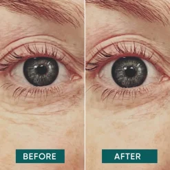 Eye pads with vitamin C - glow getter