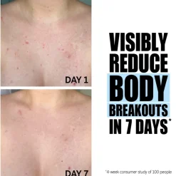 Glycolic Acid Exfoliating Body Stick