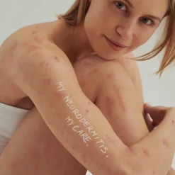 INTENSIEVE CRÈME, - Voor droge huid en neurodermitis