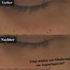 Powerful-Strength Line-Reducing & Dark Circle-Dimishing Vitamin C Eye Serum