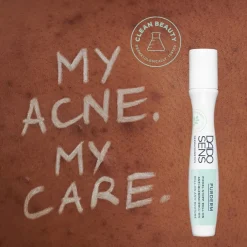 PUISTJES-STOP ROLL-ON, - voor onzuivere huid