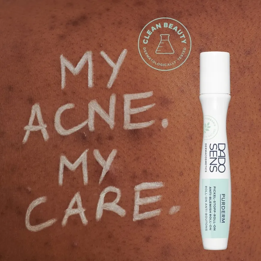 PUISTJES-STOP ROLL-ON, - voor onzuivere huid