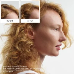 Reinigende shampoo, Natuurlijk haar progressieve uitdunning