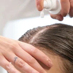 Scalp Moisturizing Lotion