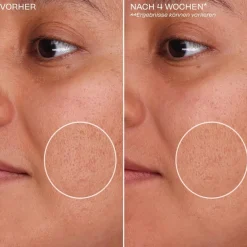 Shrink Wrap - Overnachting AHA+PHA poriënbehandeling