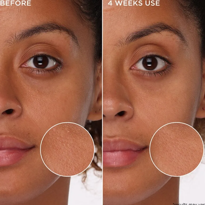 Tight 'n Toned - Poriënverfijnende schuimtoner met AHA+PHA