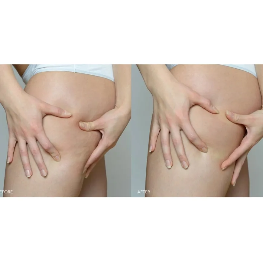 Verstevigend lichaamsserum