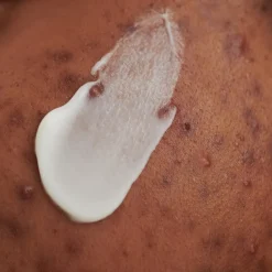 WASCRÈME, - voor onzuivere huid